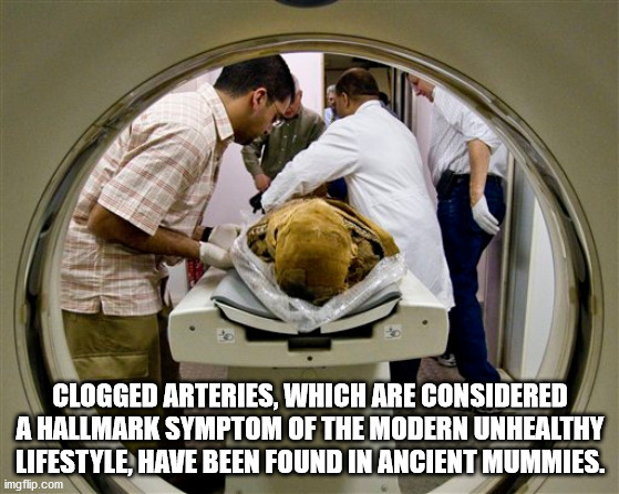 Mummy - Clogged Arteries, Which Are Considered A Hallmark Symptom Of The Modern Unhealthy Lifestyle, Have Been Found In Ancient Mummies. imgflip.com