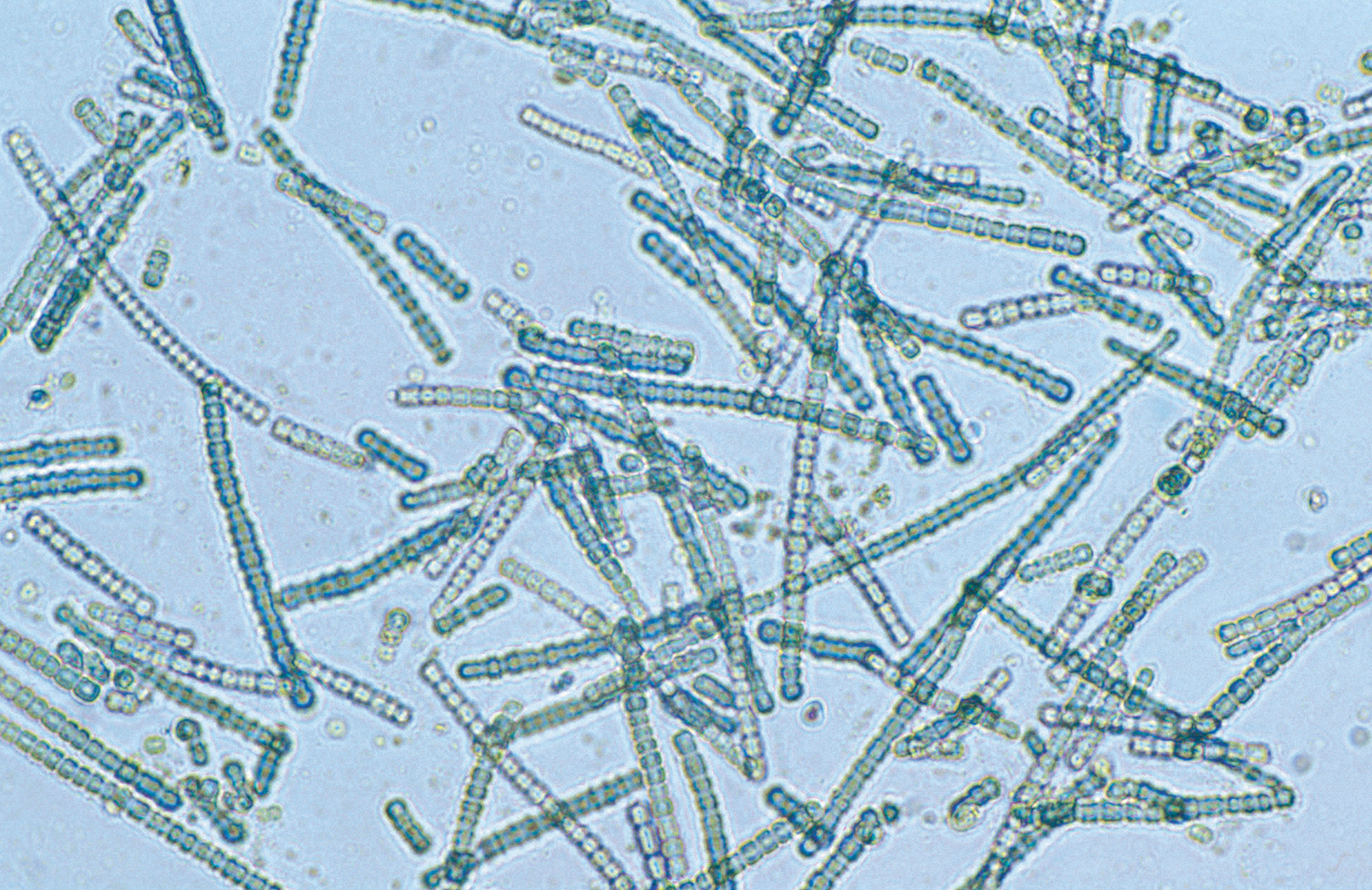 microscope blue green algae