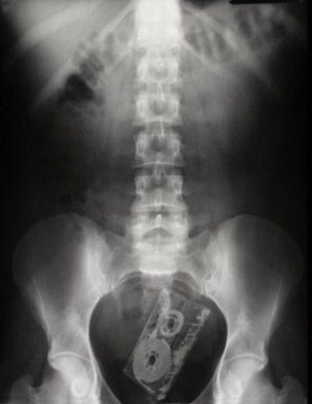 interesting x rays