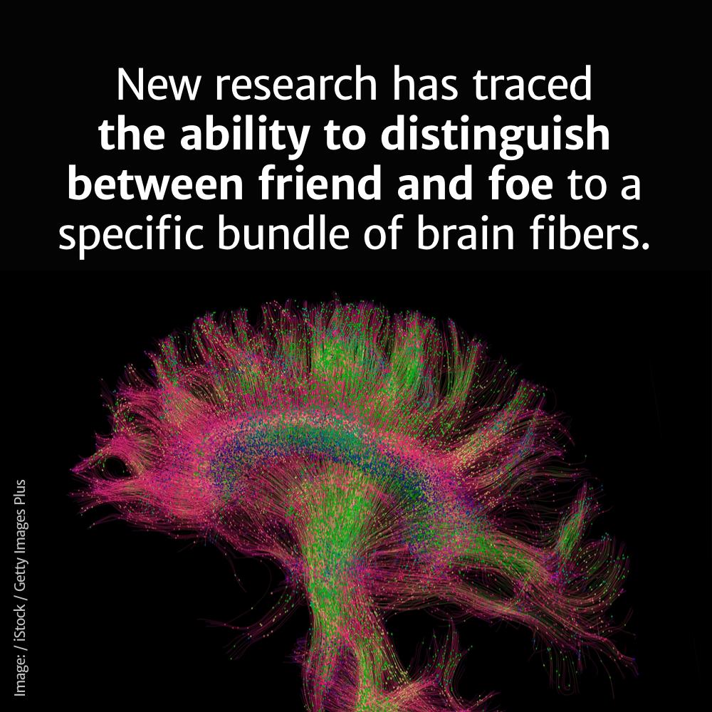 Diffusion MRI - New research has traced the ability to distinguish between friend and foe to a specific bundle of brain fibers. Image iStock Getty Images Plus