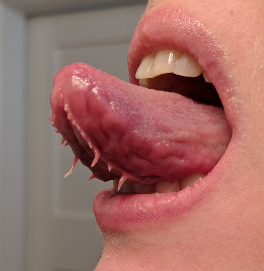 I have tentacles under my tongue- apparently not everyone does?