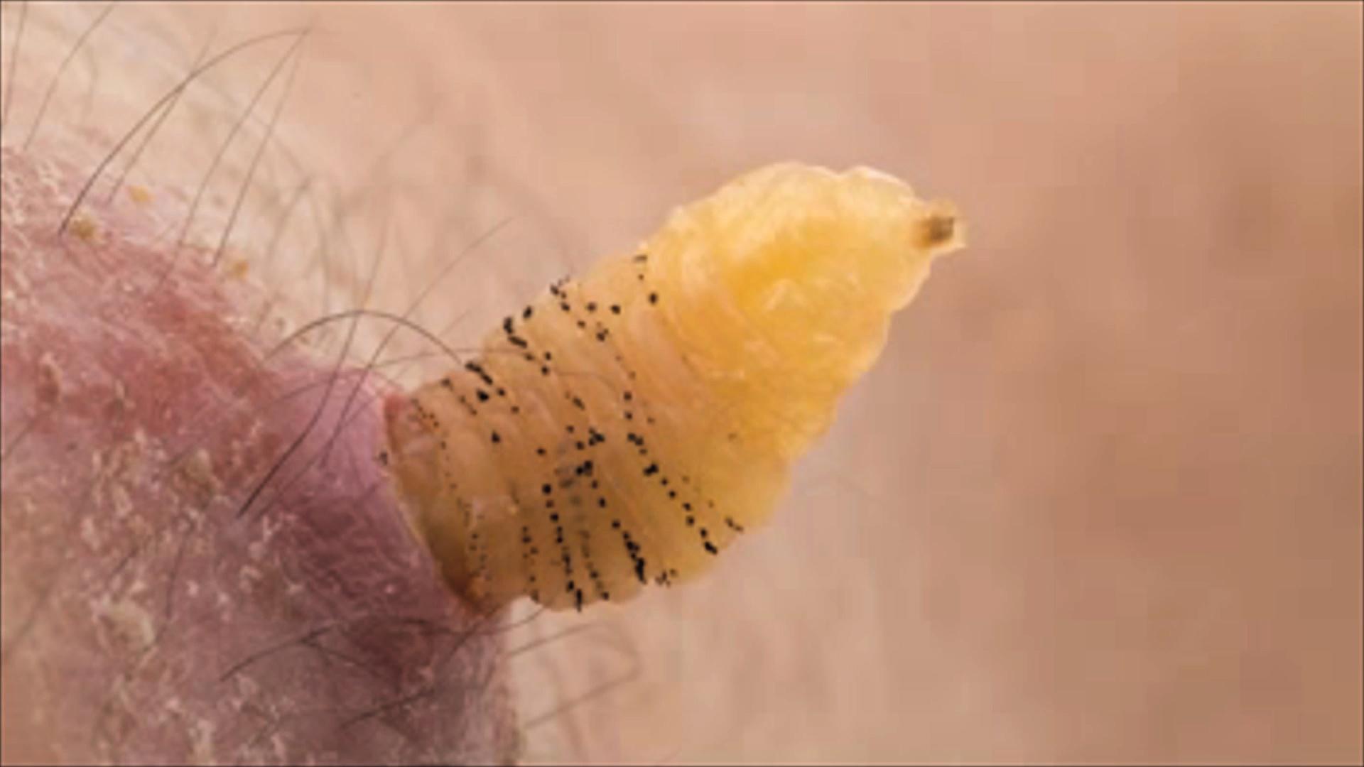 Here's another great closeup demonstrating the wonders of nature - the birth of a human bot fly. Bot flies reproduce by laying eggs inside the skin of living creatures, in this case humans. The eggs hatch and the larva eats its way back out of your skin to find freedom and begin the cycle anew.