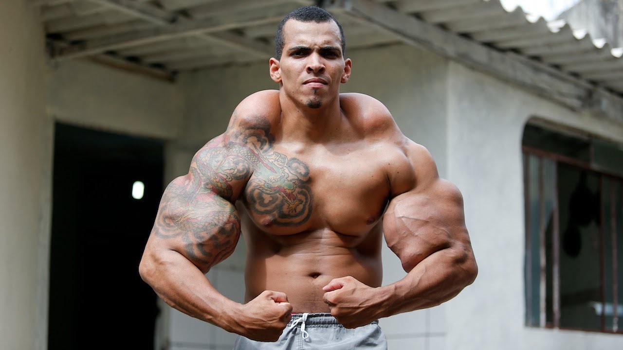 On the topic of self-abuse, this "bodybuilder" filled his tissues with low-quality cement to make himself look bigger. Those bulges you see? Hard as rocks and incredibly painful.