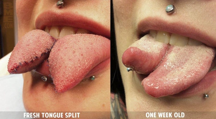 Did you know that you can pay someone to give you a snake tongue? It's totally legal and completely horrifying to look at.