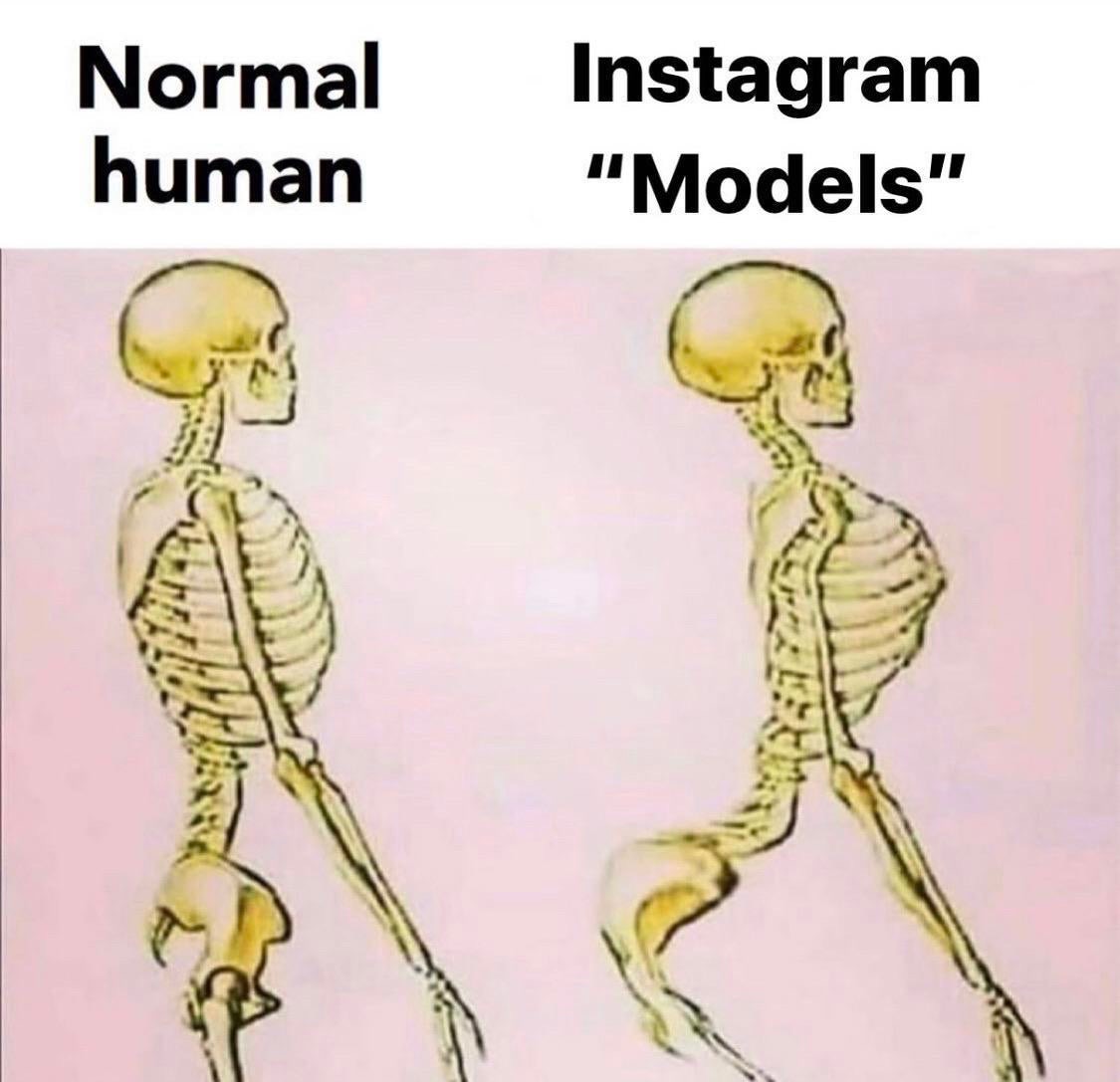 raheem sterling skeleton - Normal human Instagram "Models"