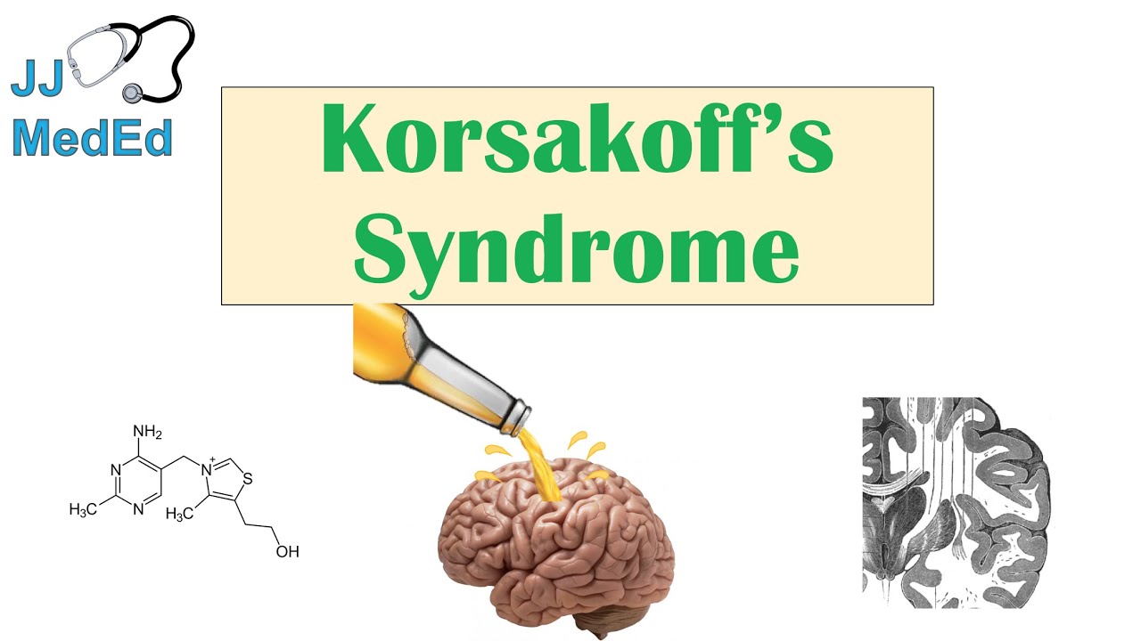 Real Conditions that sound fake  - korsakoff's psychosis - Jj MedEd Korsakoff's Syndrome NH2 Sr H3C H3C Oh