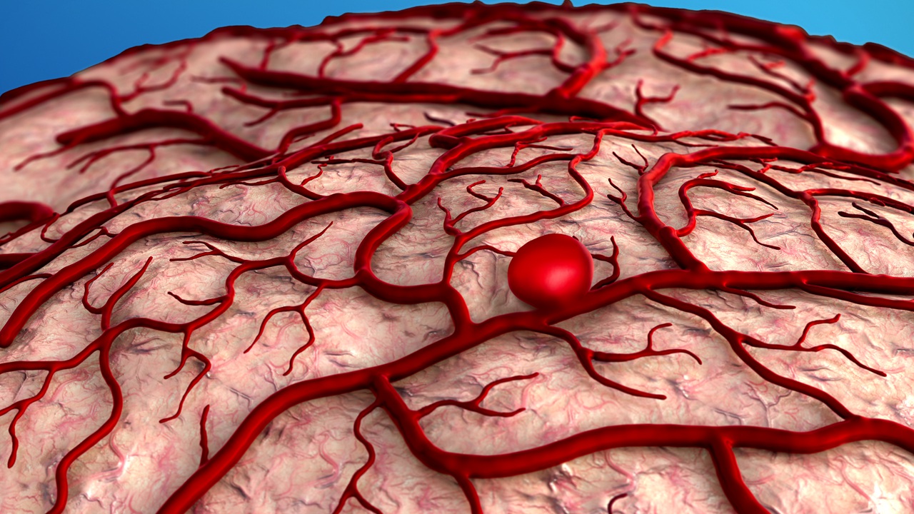 scary science facts - brain aneurysm