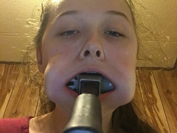 advice for younger self - girl with hammer stuck in mouth