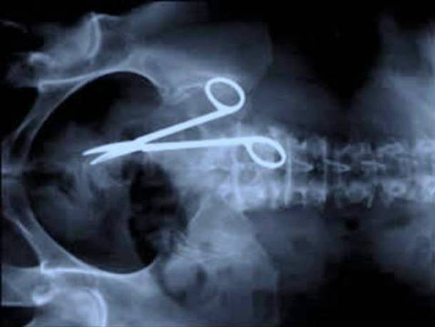 That those funny X-rays of odd objects inside of someone is not as a result of someone swallowing it whole. -u/raspberrypigeon