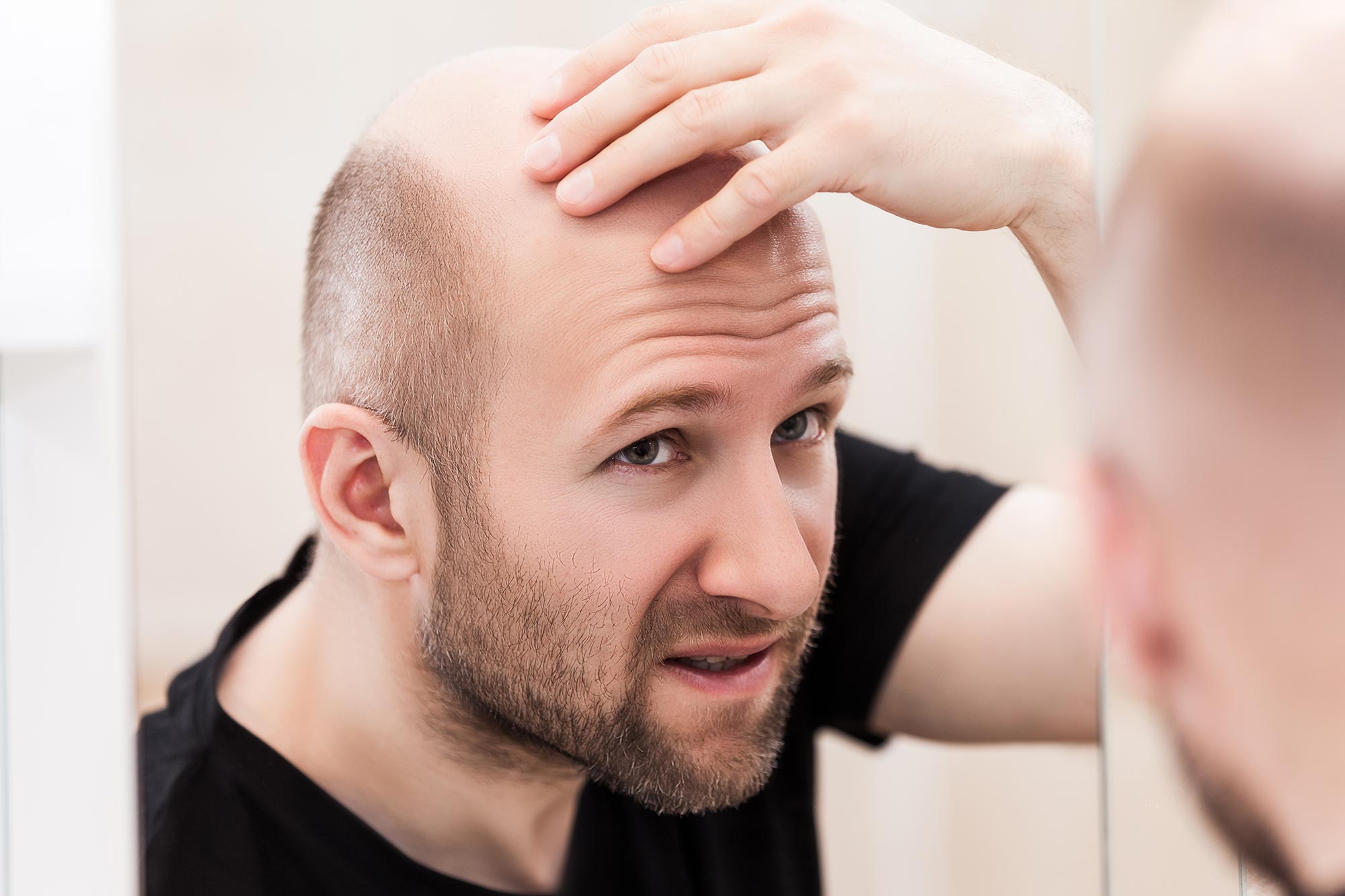 Never Ask these questions - hair loss