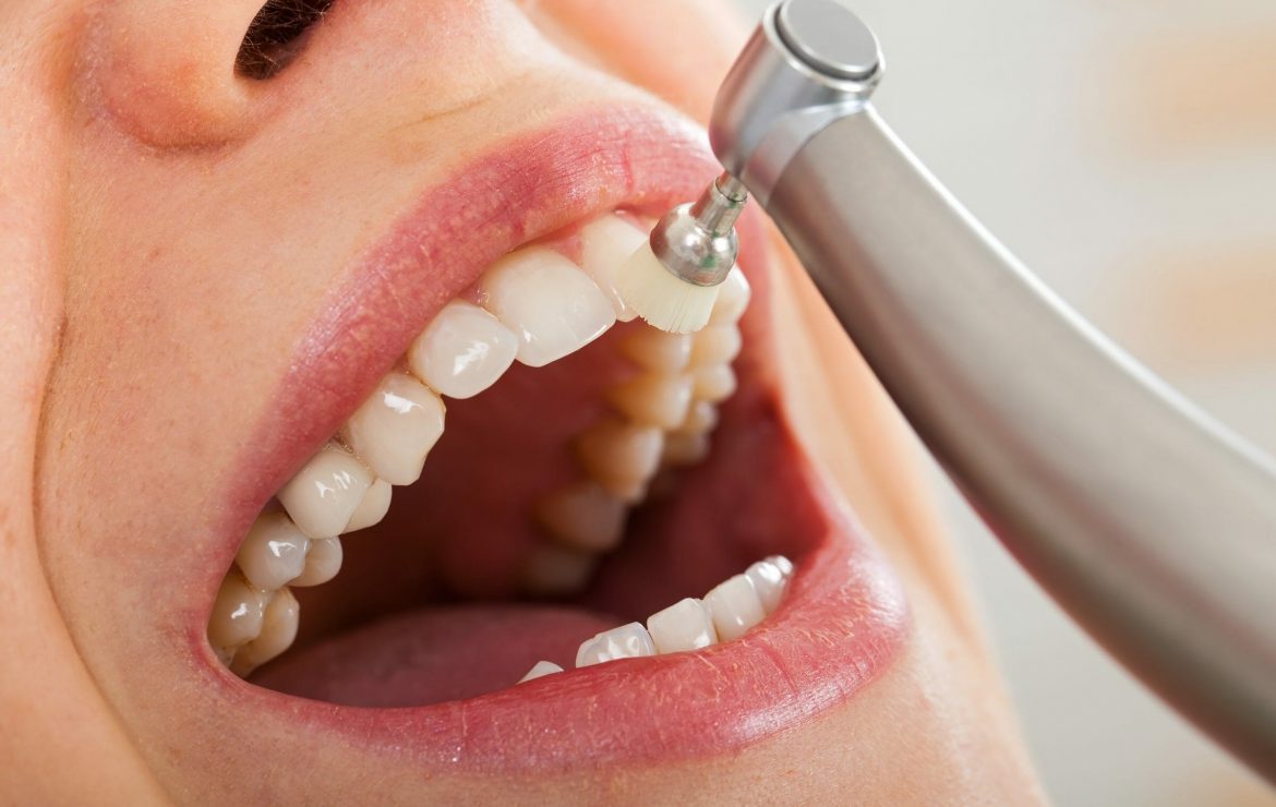 common knowledge it took us too long to learn - dental teeth cleaning