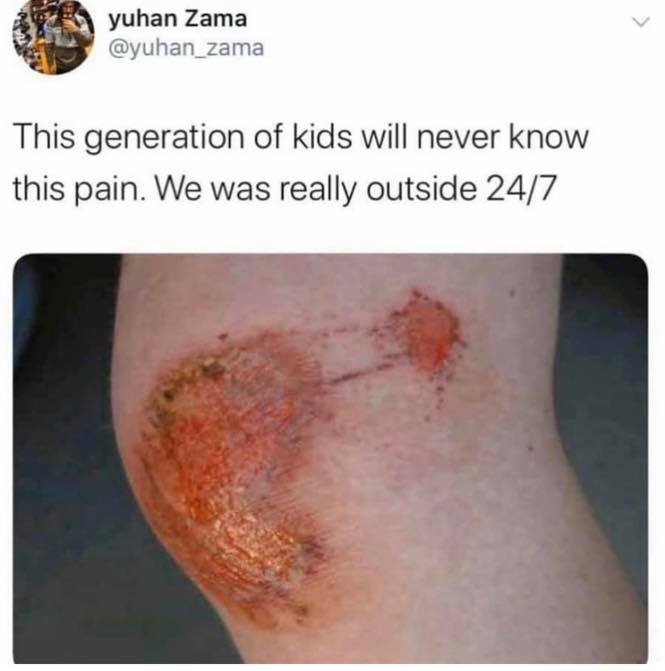 disease - yuhan Zama This generation of kids will never know this pain. We was really outside 247