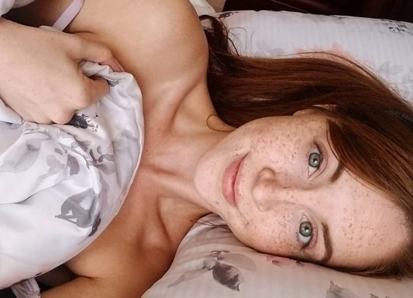 36 Pics of Hot Babes With Freckles