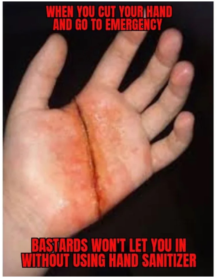 hand - When You Cut Your Hand And Go To Emergency Bastards Won'T Let You In Without Using Hand Sanitizer