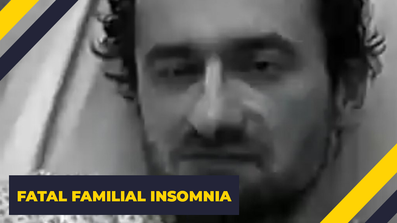 man - Fatal Familial Insomnia