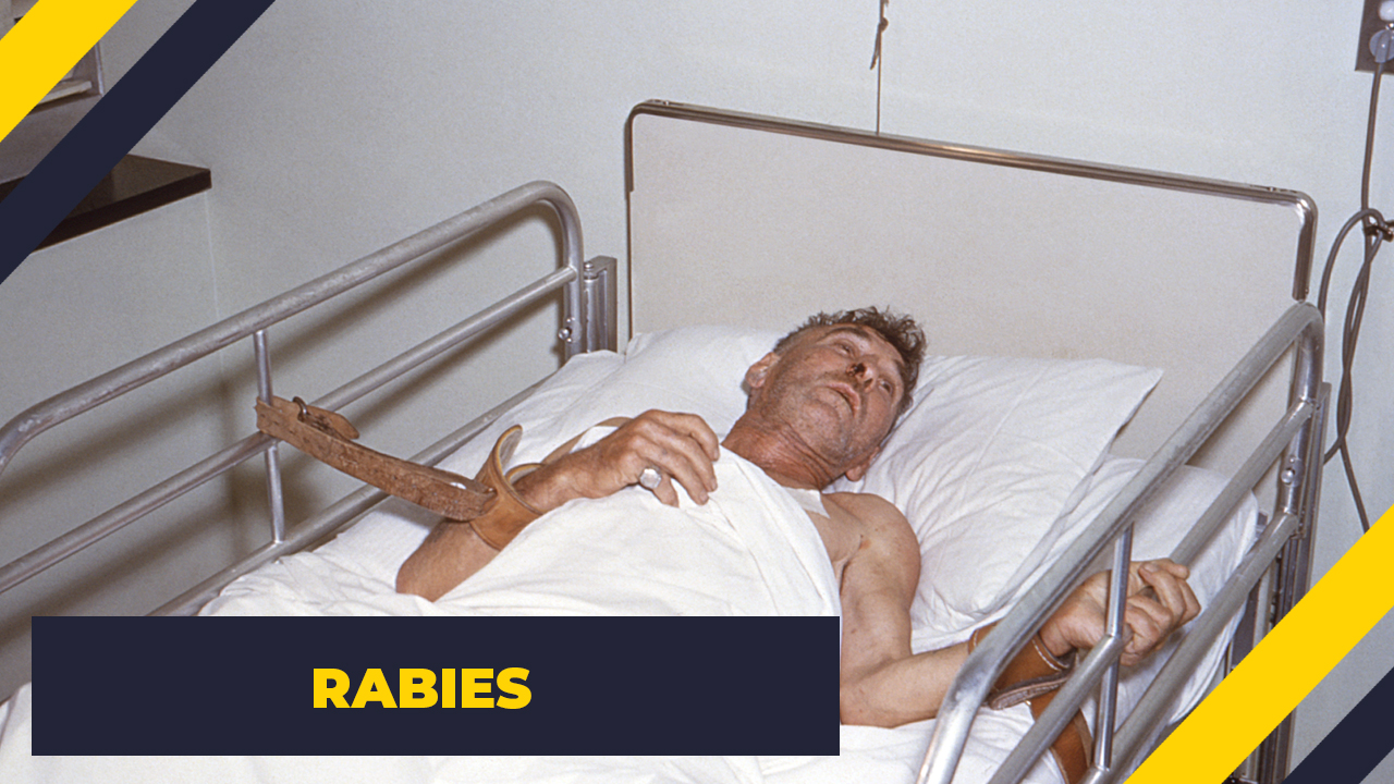 rabies in person - Rabies