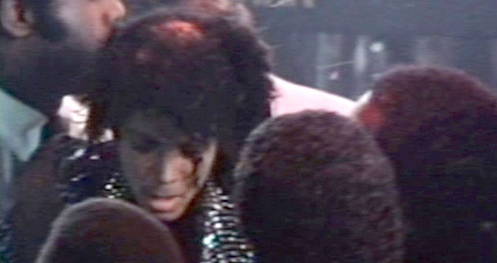 hard to believe facts - Michael Jackson's hair caught fire on 27 Jan 1984 which was the exact midpoint of his life.