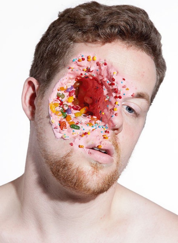 Candy Face Injuries