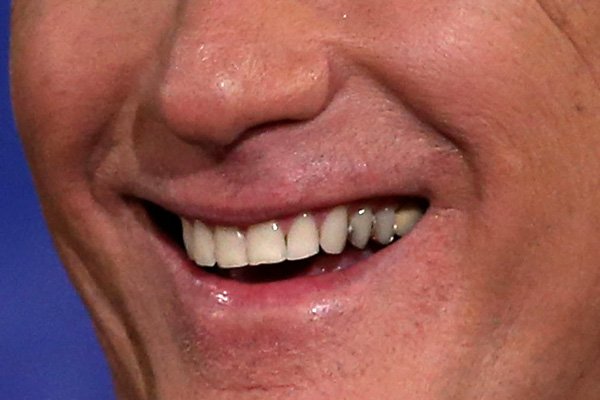Known for his perfect hair, this politician has a pretty nice set of chompers, too.