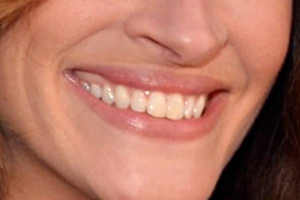 This actress might have the most famous smile of all. Hint: She's played everything from a waitress at a pizzeria to an environmental whistleblower, and her megawatt grin makes her a very pretty woman.
