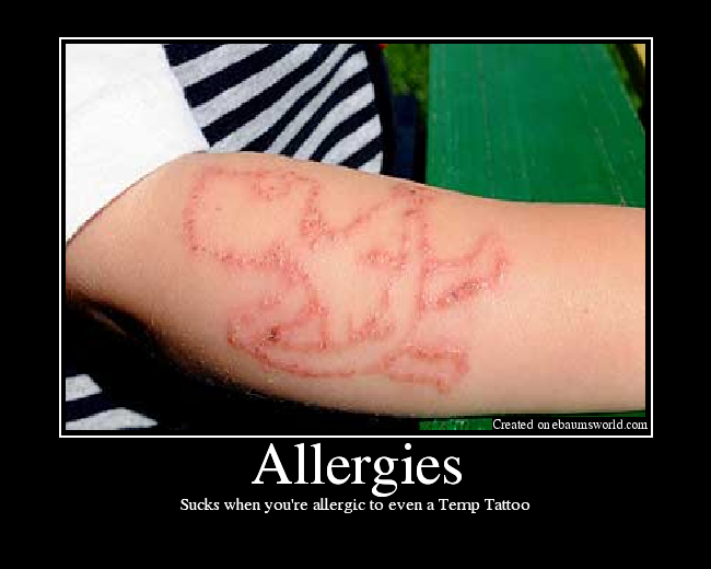 Sucks when you're allergic to even a Temp Tattoo