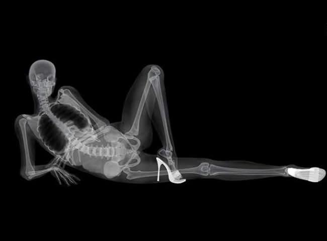 X-ray Models...