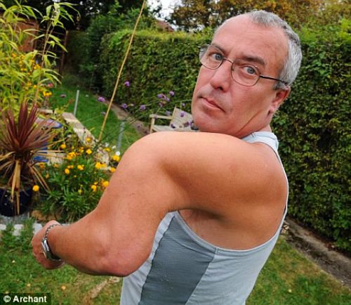 A plumber whose arm was left twisted grotesquely out of shape in an accident ten months ago has had an operation to correct it cancelled four times. Torron Eeles, 50, has been left unable to work since falling down the stairs and now fears he may lose his home after being denied incapacity benefit. The father-of-three today hit out at the NHS for t