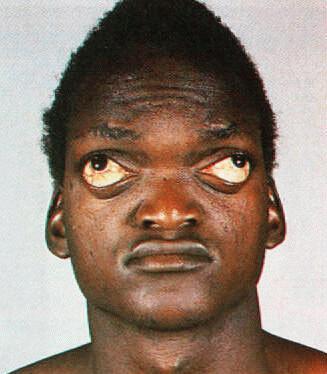 black guy with a weird face and crazy ass eyes