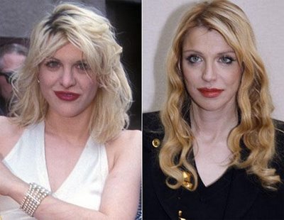 The World Record Holders of Plastic Surgery