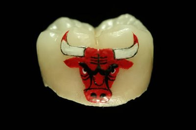 Tooth Painting