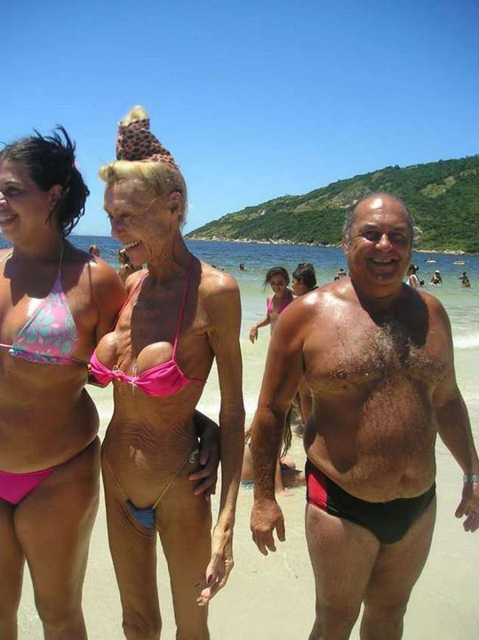 What happens when someone with implants gets old...and why is Danny Devito so happy???