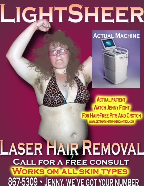 LightSheer Laser Hair Removal