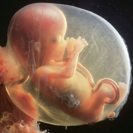 Fetuses have erections. That’s right, and ultrasound scans prove it. So many newborn males greet the world with an erection that the sexologist William Masters in his earlier obstetric days set himself the challenge of trying to cut the umbilical cord before it happened.