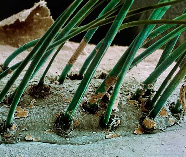  Eyelash hairs growing from the surface of human skin