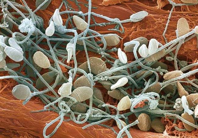 Human sperm (spermatozoa), the male sex cells