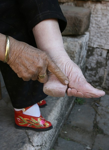 Chinese Foot Binding