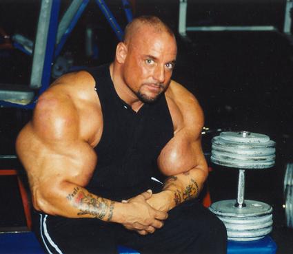 This is an actual picture of a guy named Greg Valentino who overdosed on Anabolic Steroids to have the biggest arms in the world....he succeded