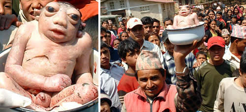 This has got to be the most bizarre birth defect ever!
