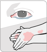 Be on the lookout for terrorists with pinkeye and leprosy. Also, they tend to rub their hands together manically.