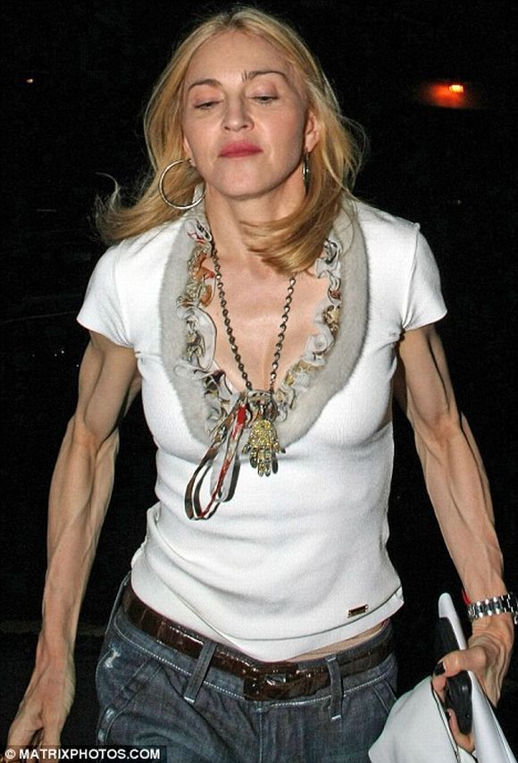 Madonna's Skeleton