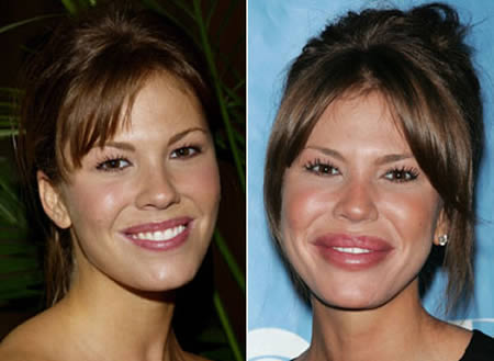 21 Disasters of Plastic Surgery