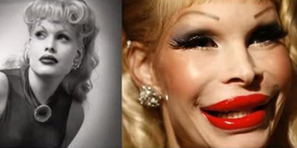 21 Disasters of Plastic Surgery