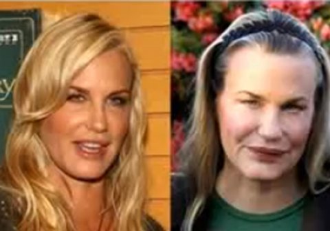 21 Disasters of Plastic Surgery