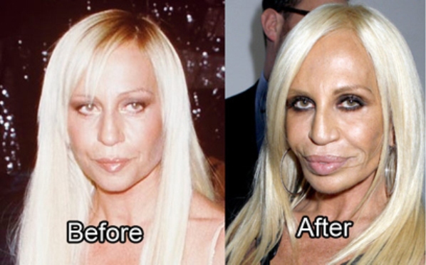 21 Disasters of Plastic Surgery