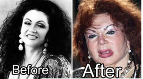 21 Disasters of Plastic Surgery