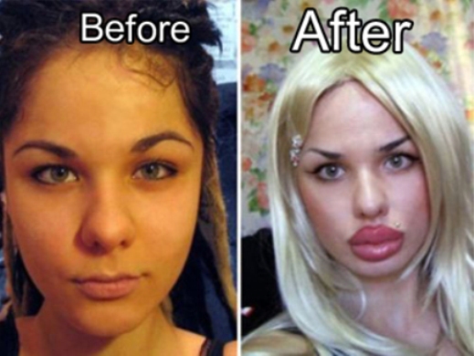 21 Disasters of Plastic Surgery