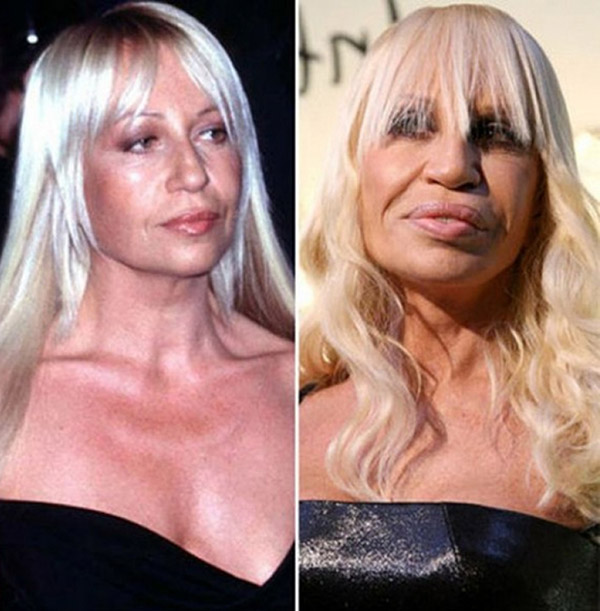 21 Disasters of Plastic Surgery