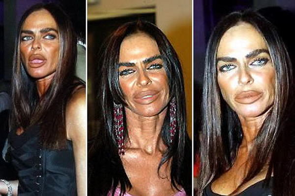 21 Disasters of Plastic Surgery