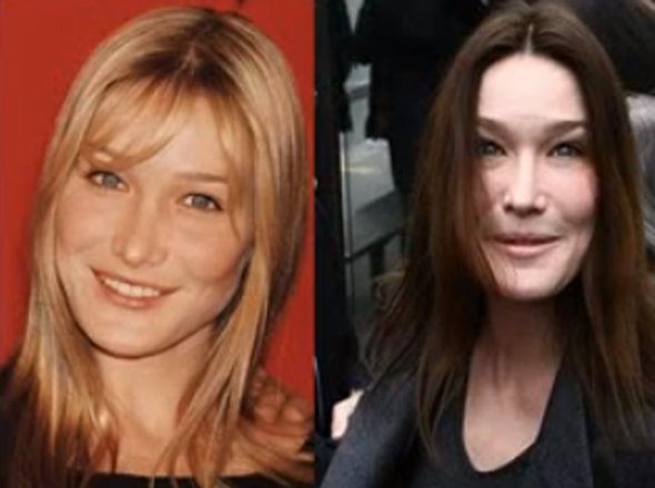 21 Disasters of Plastic Surgery