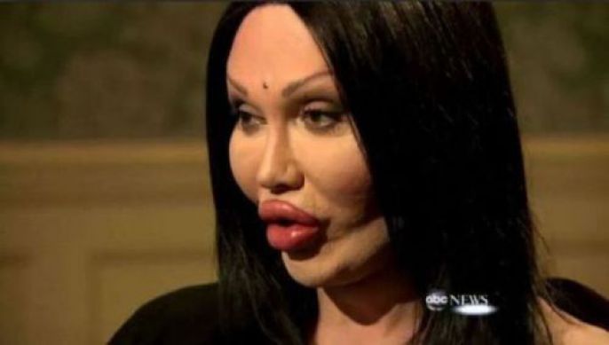 21 Disasters of Plastic Surgery